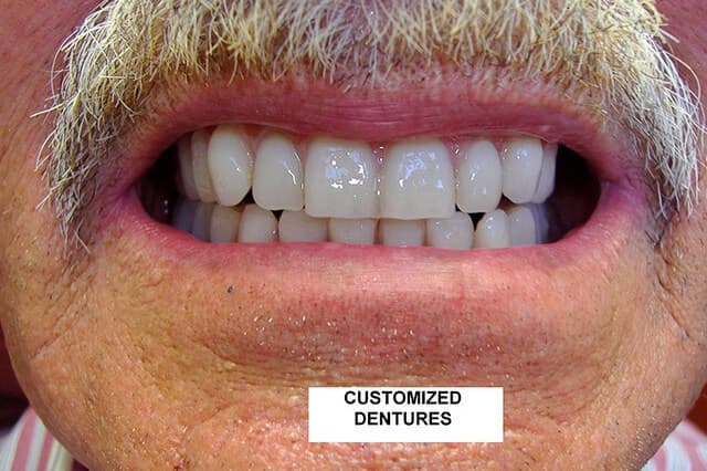 Magnolia Dental - Dentures Before and After