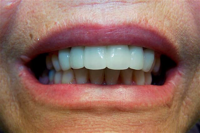Magnolia Dental - Mislagned Teeth After
